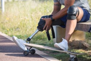 Beyond the Bruise: Unlocking Your Best Self with Capri Health and Rehab